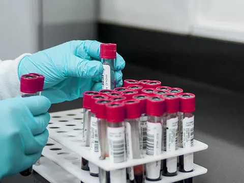 Curso–Taller de Toma de Muestras Sanguíneas basado en la Guía CLSI GP41: Procedimientos Normalizados para Flebotomía