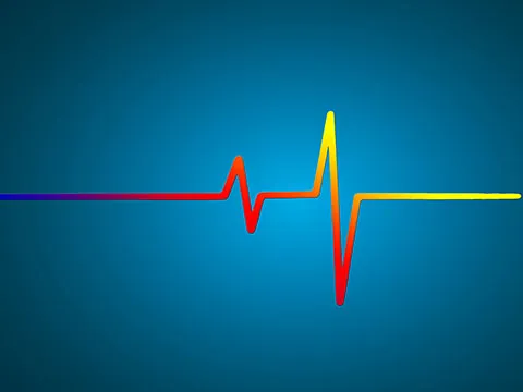 Taller Interpretación basica de Electrocardiograma